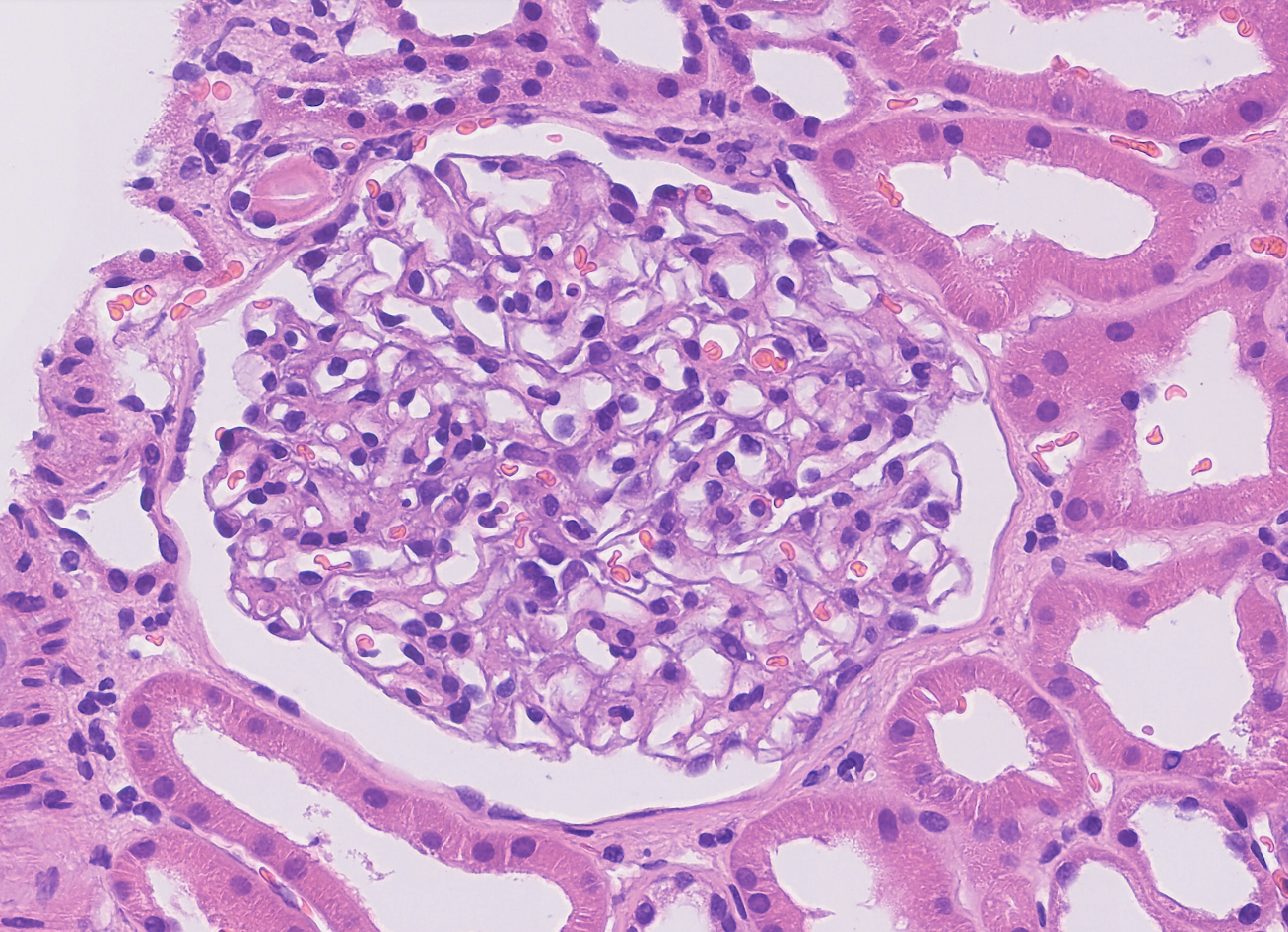 Glomeruli thumbnail